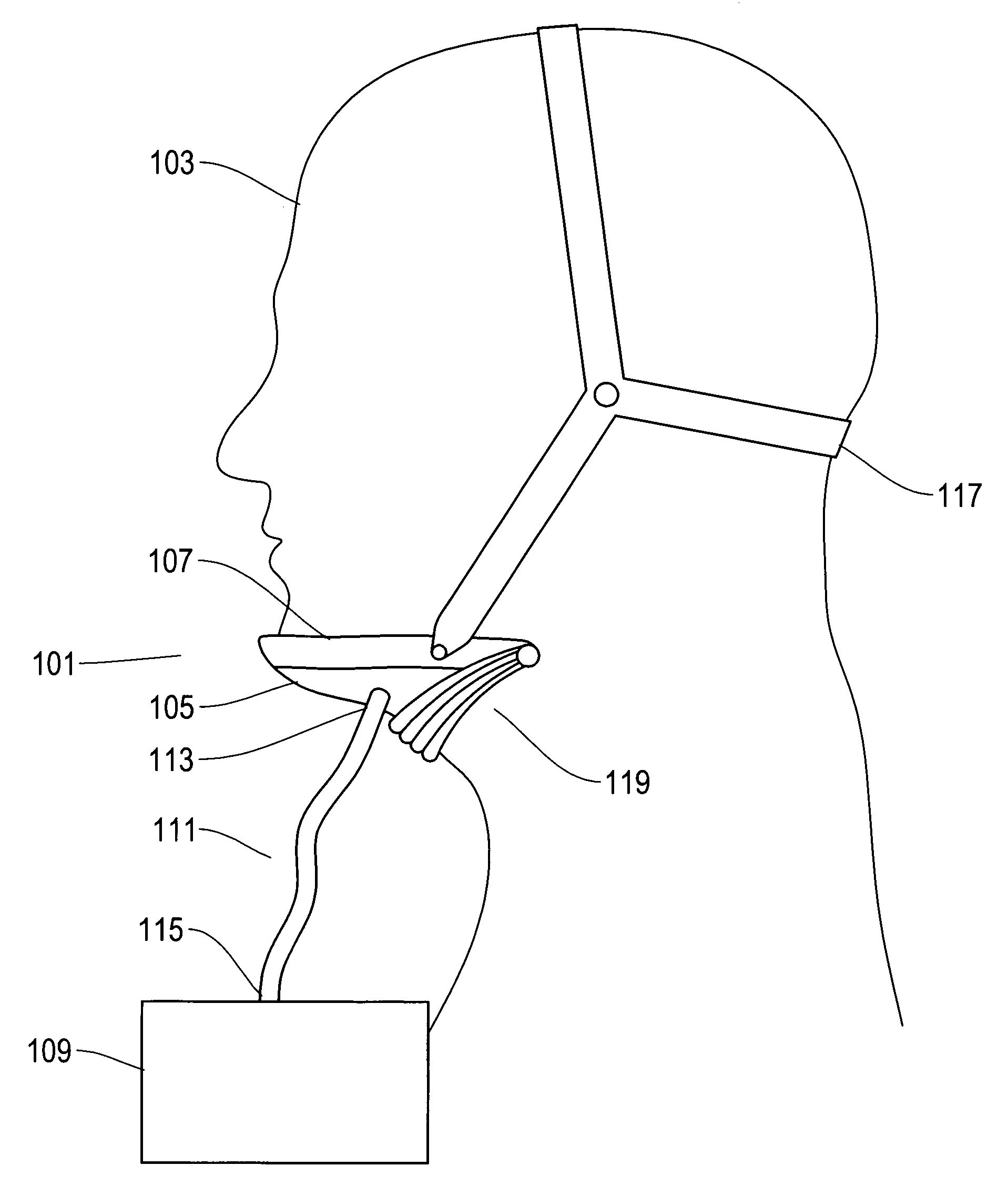 Device and method for opening an airway