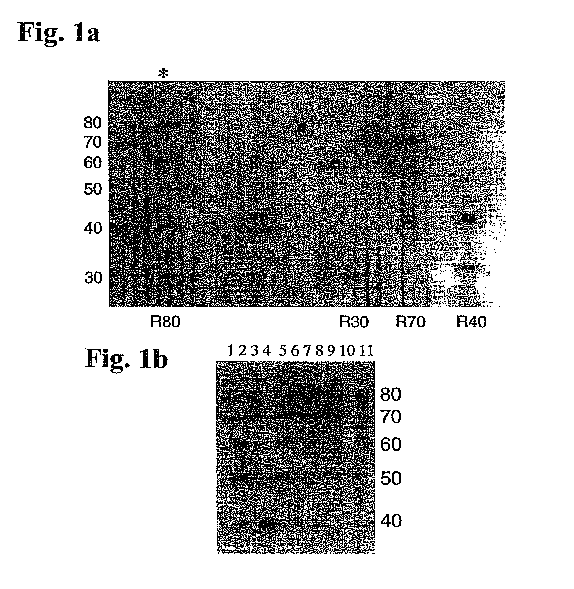 Spinocerebellar ataxia type 8 and methods of detection