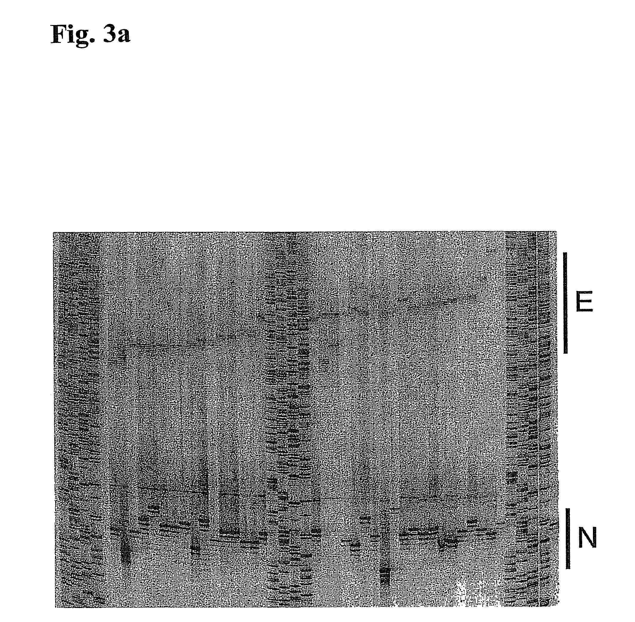 Spinocerebellar ataxia type 8 and methods of detection