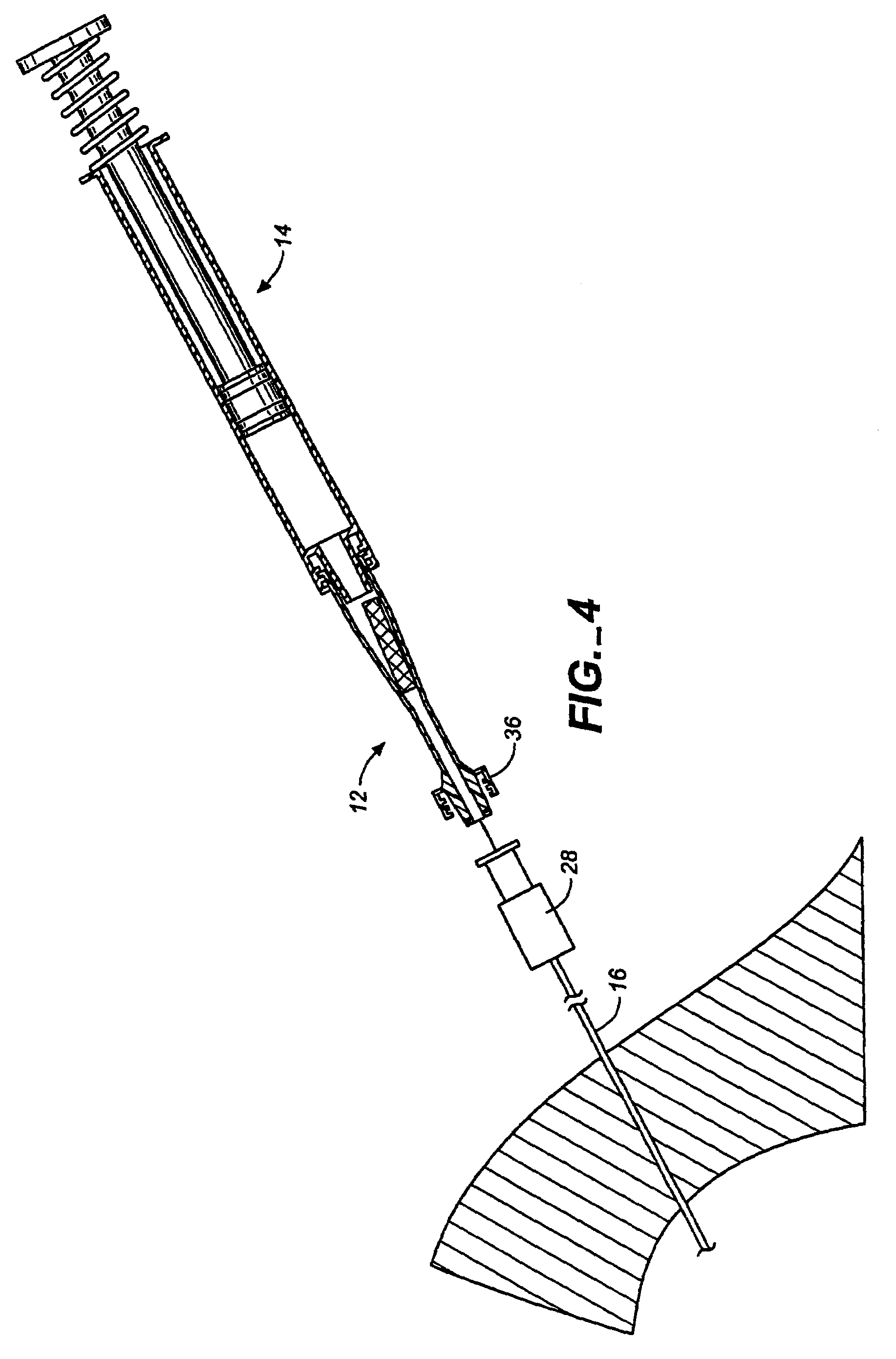 Absorbable sponge with contrasting agent