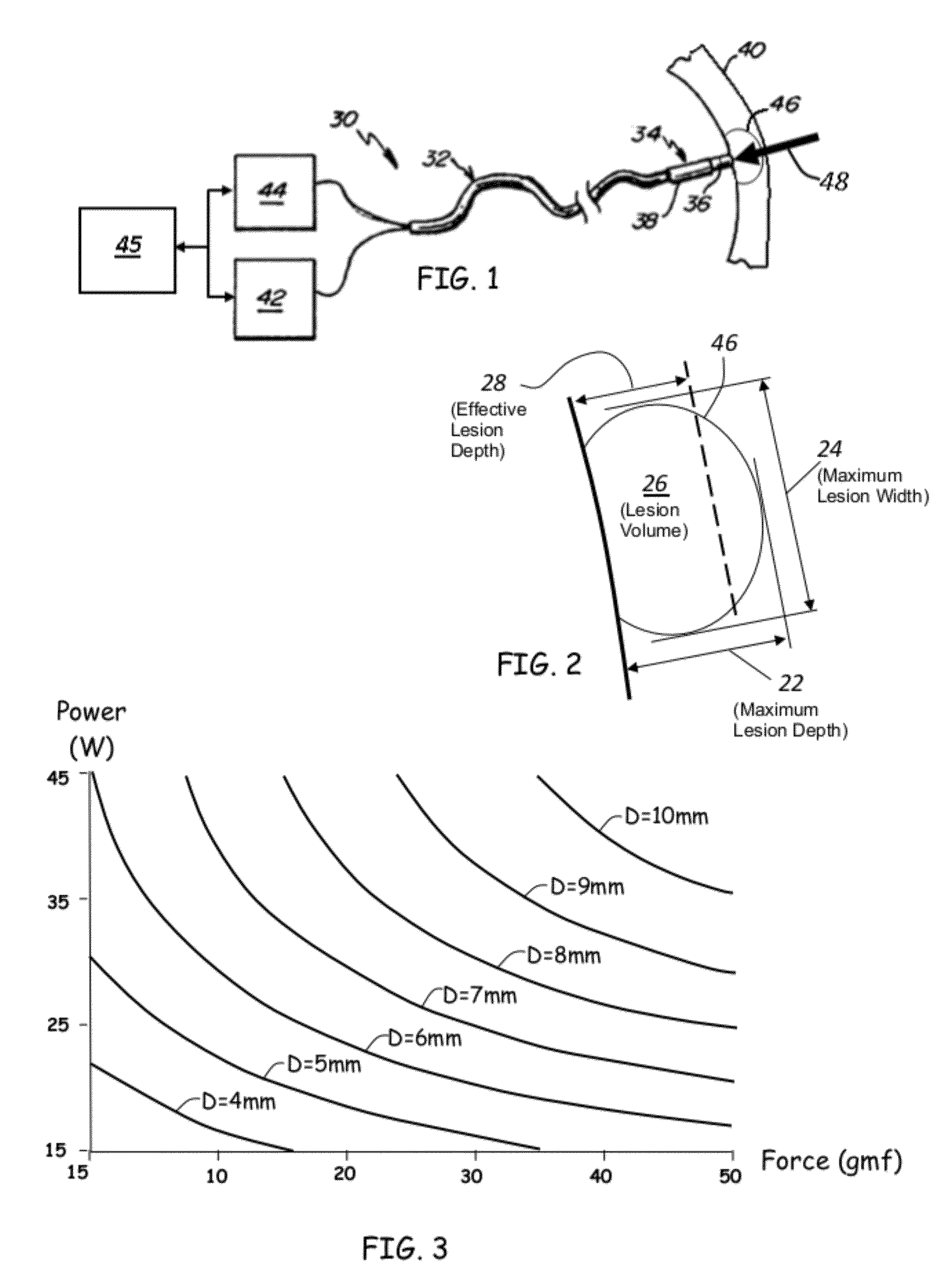 Prediction of atrial wall electrical reconnection based on contact force measured during RF ablation