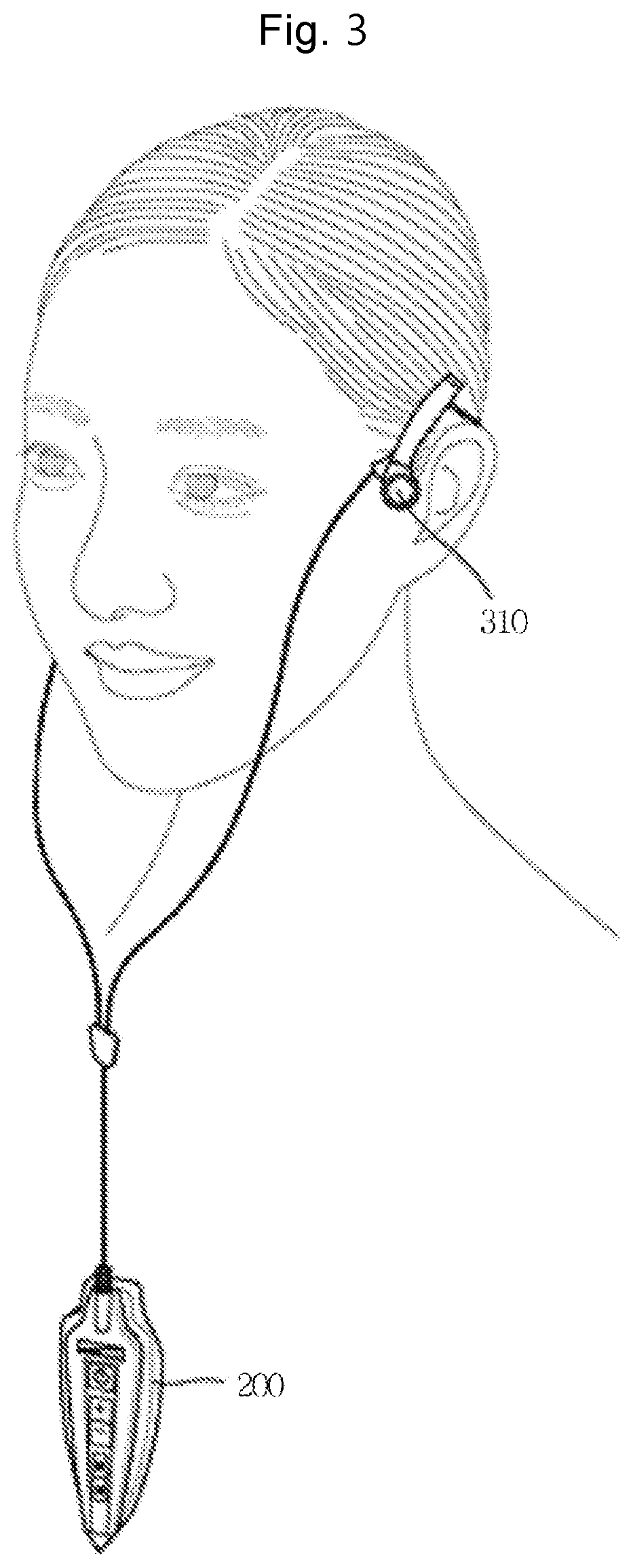 Bone conduction apparatus having tens therapy function