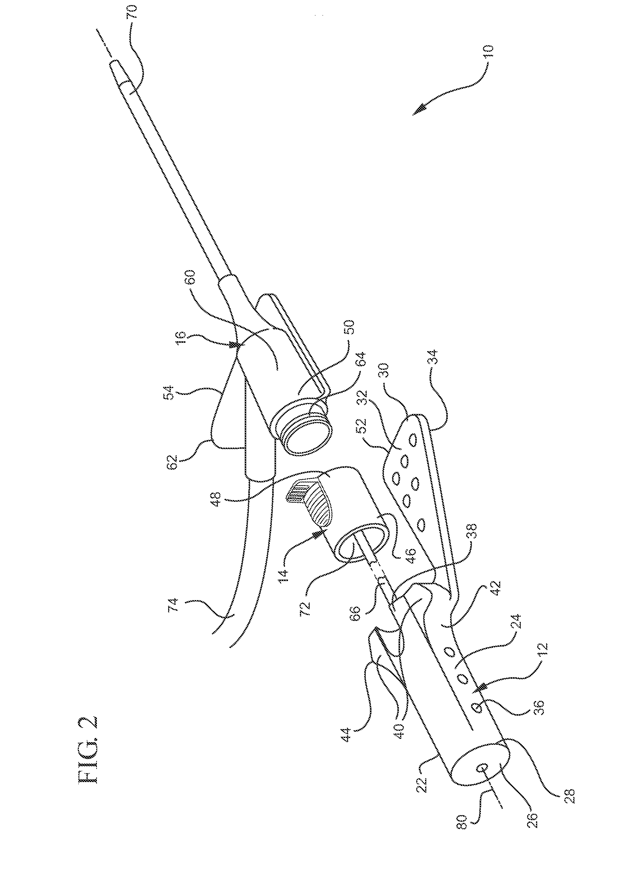 Systems and methods for providing a safety integrated catheter with universal grip