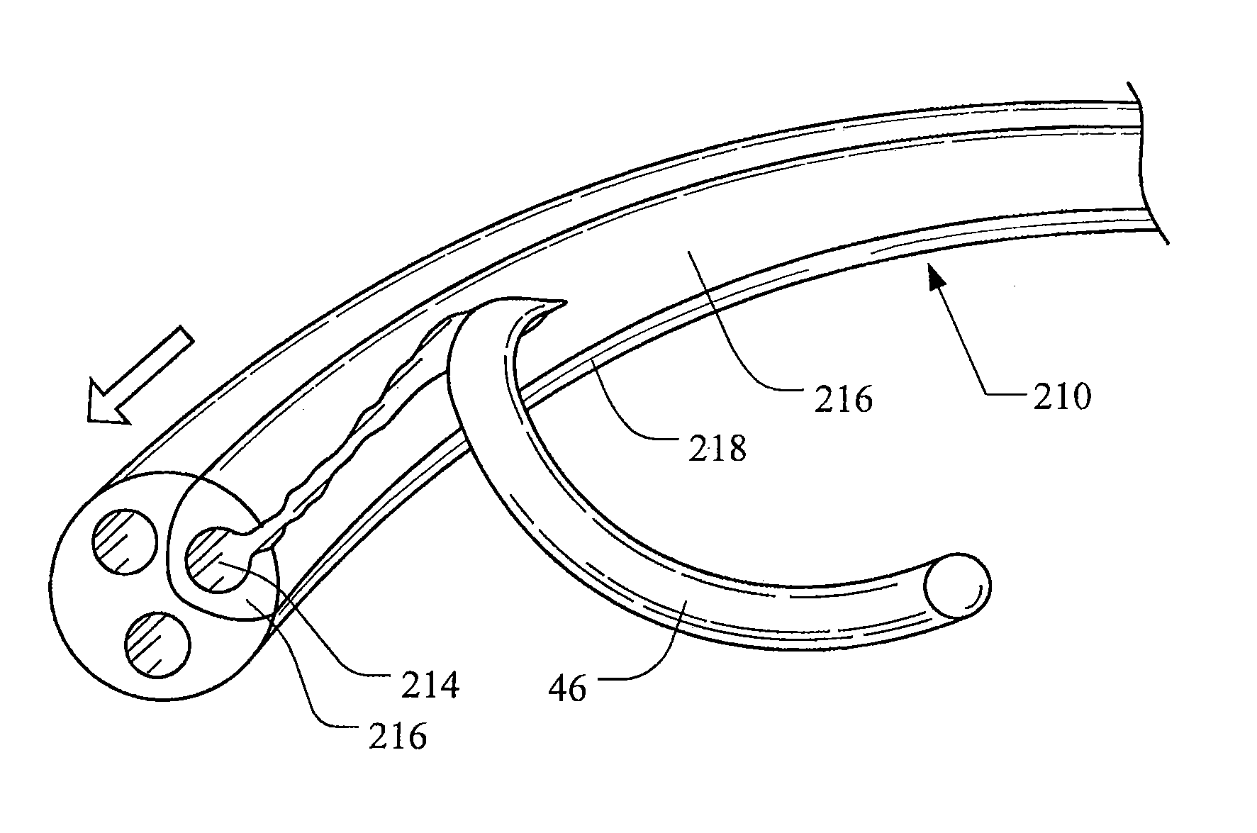 Catheter with splittable wall shaft and peel tool