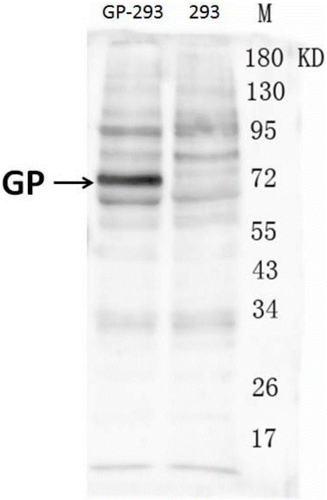 Hybridoma cell strain ZJEB8-01, Ebola-virus GP albumen resistant monoclonal antibody, and preparation and application of Ebola-virus GP albumen resistant monoclonal antibody