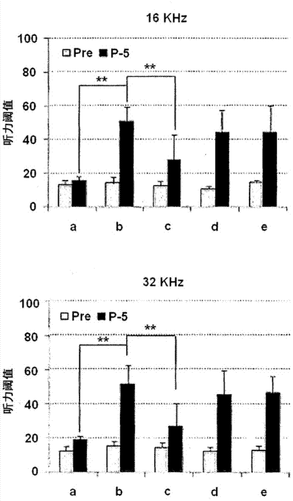 Pharmaceutical composition for preventing or treating hearing loss