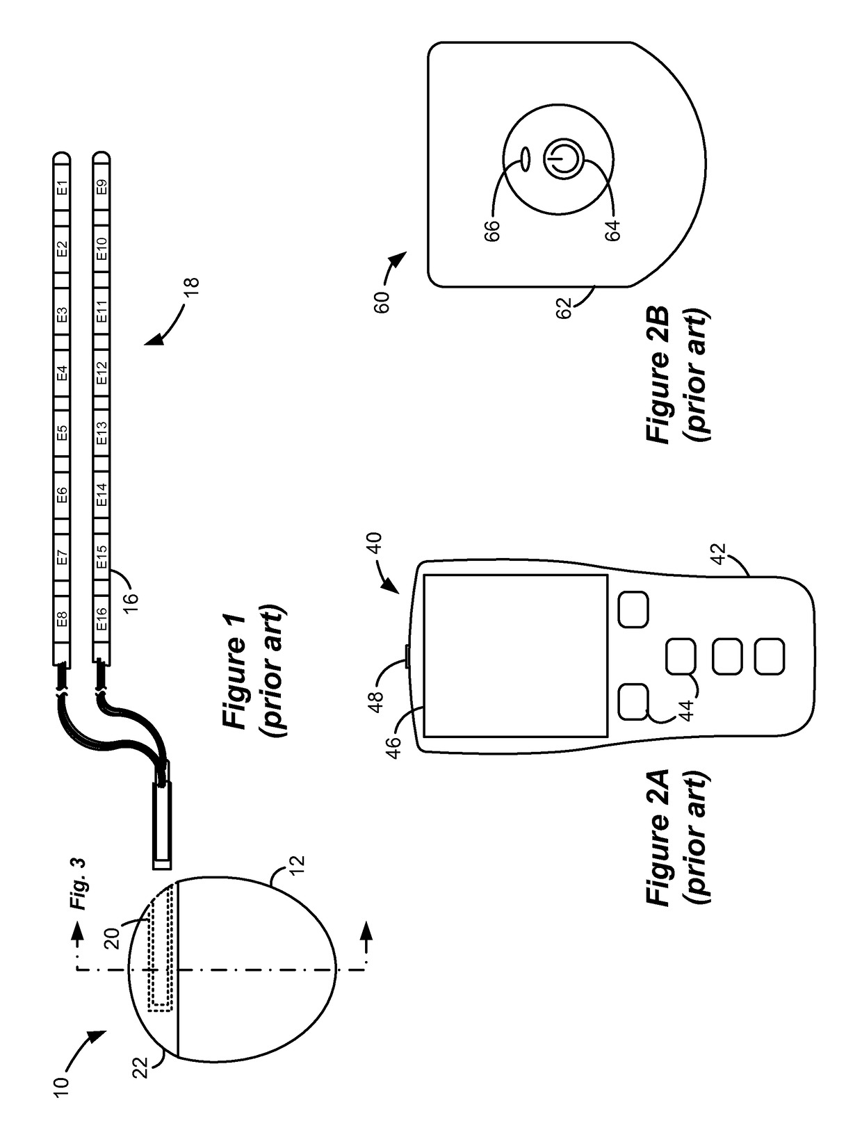 External charging coil assembly for charging a medical device
