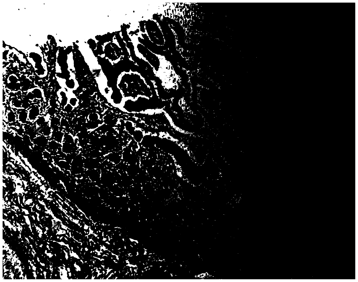 Improved Hale colloidal iron staining method and kit for displaying goblet cells