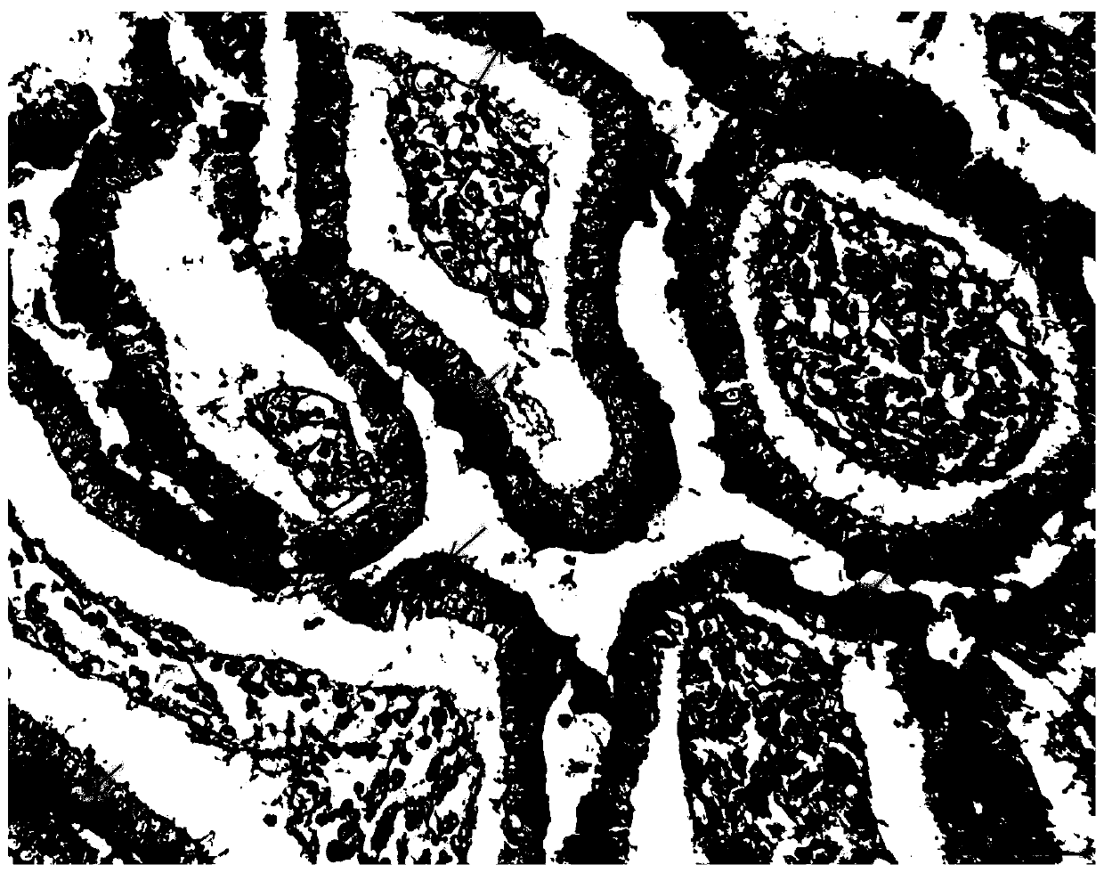 Improved Hale colloidal iron staining method and kit for displaying goblet cells