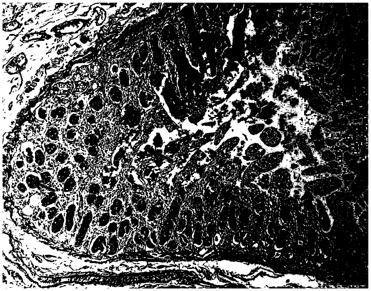 Improved Hale colloidal iron staining method and kit for displaying goblet cells