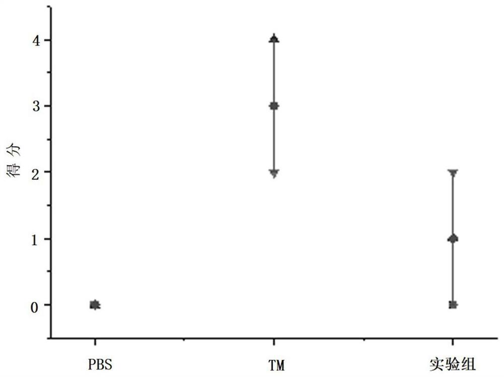 Bacteroides thetaiotaomicron and application thereof