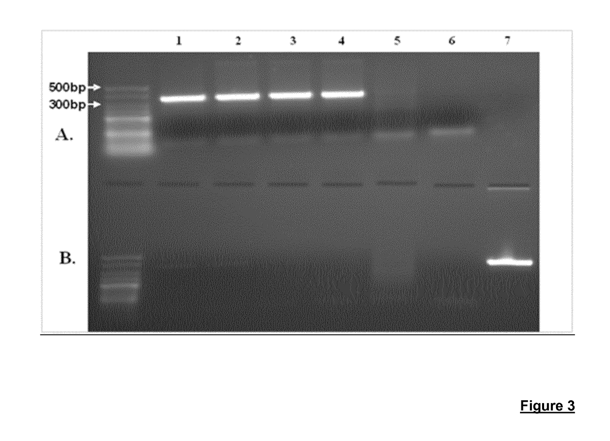 Production of large-sized microdystrophins in an aav-based vector configuration