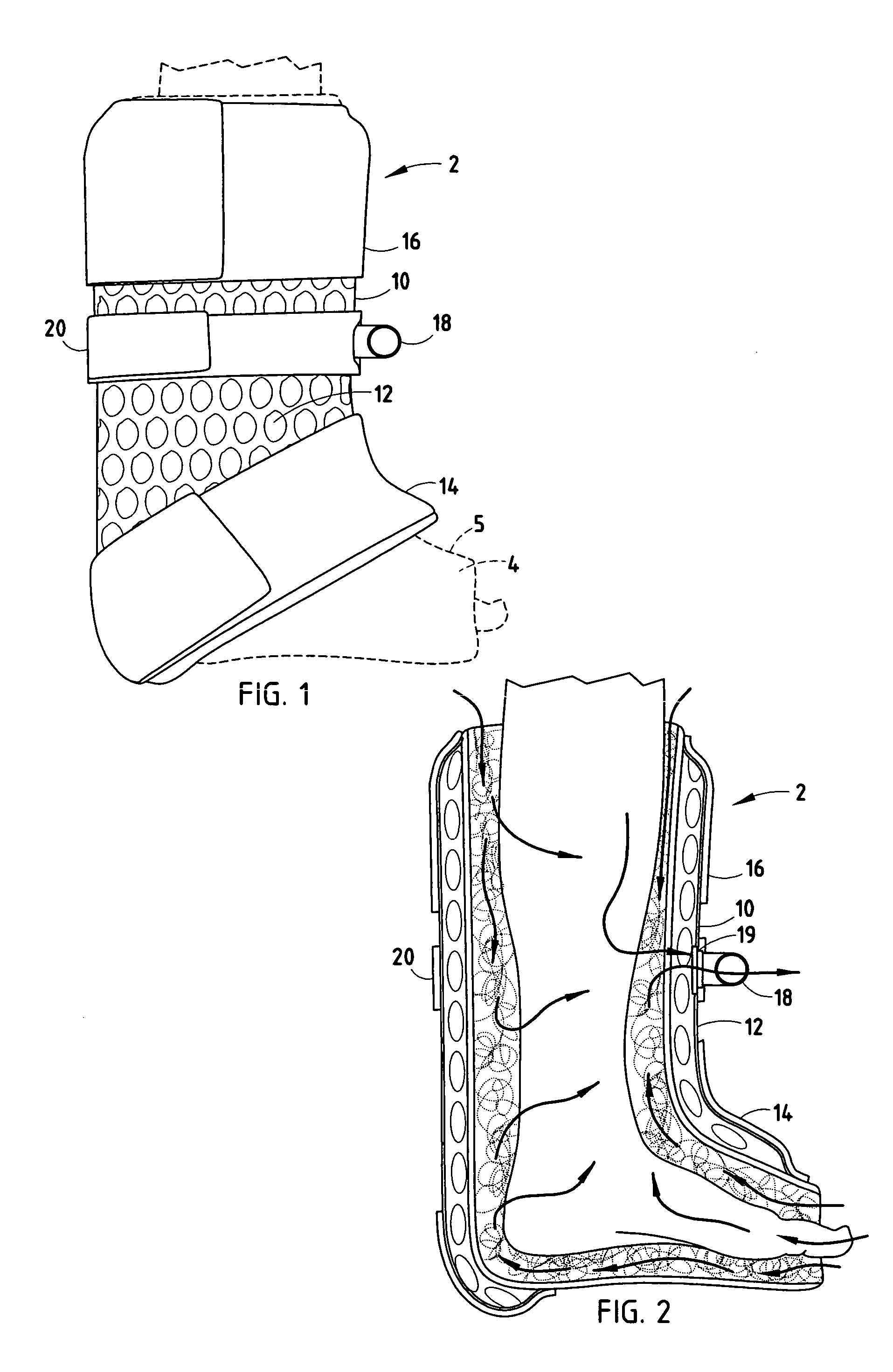 Method and apparatus for aerating a cast