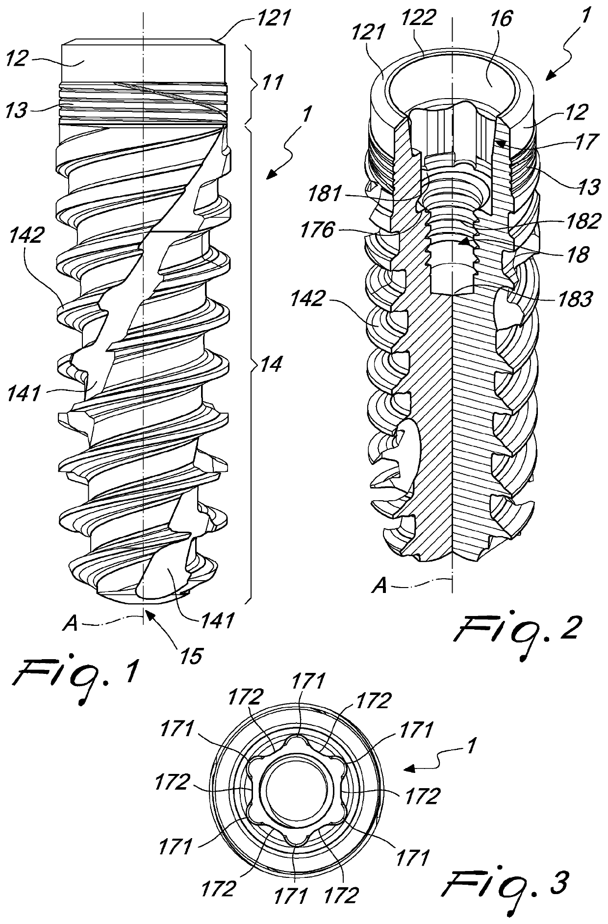 Improved dental implant system