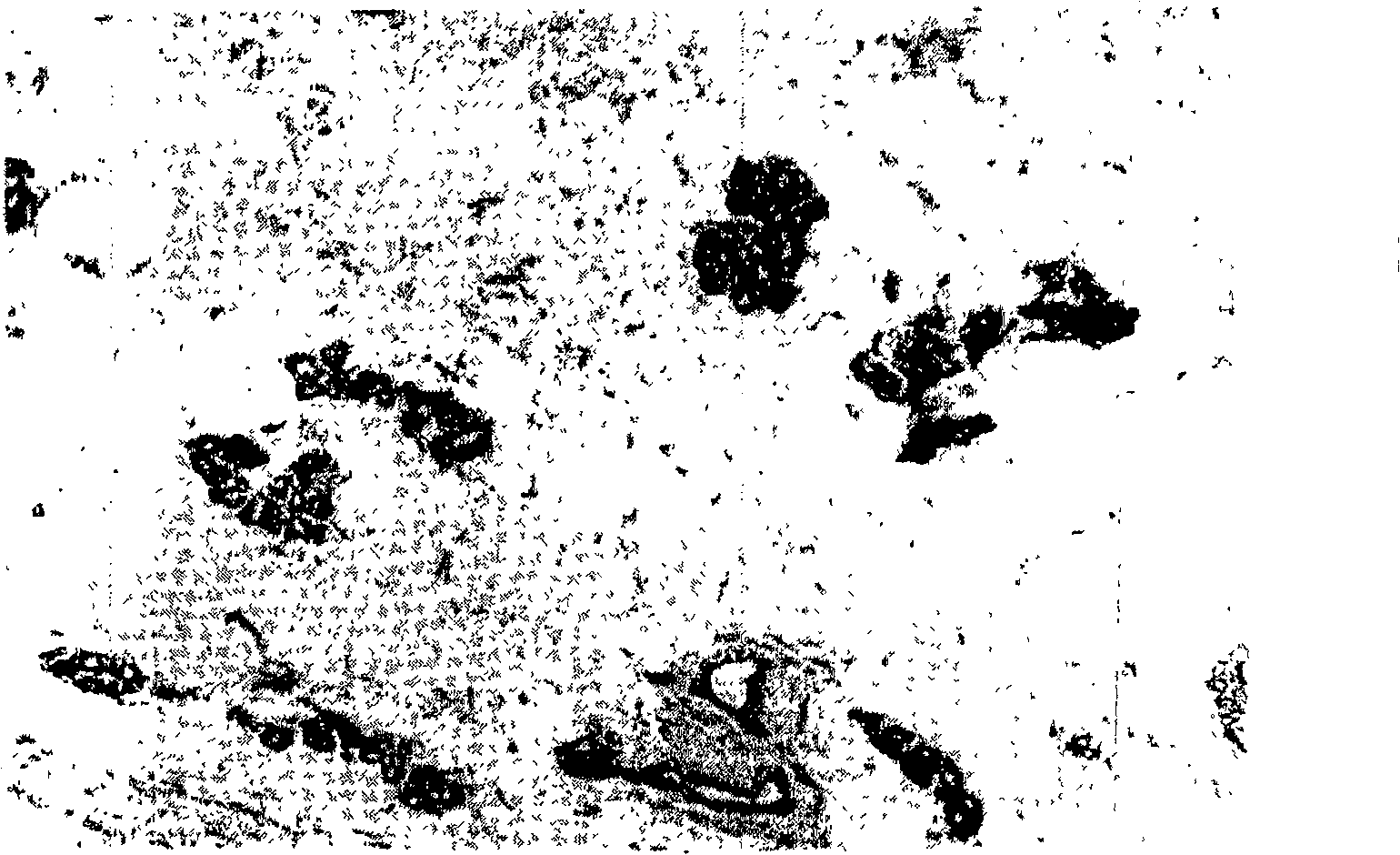 Medicine composition for treating mammary gland hyperplasia and its extracting preparing method