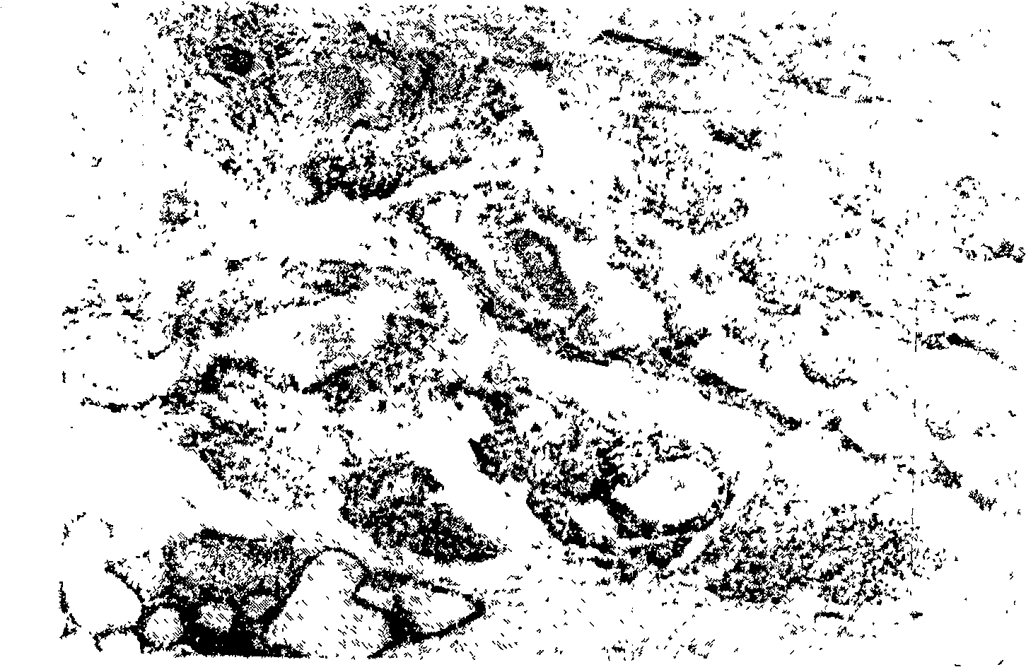 Medicine composition for treating mammary gland hyperplasia and its extracting preparing method