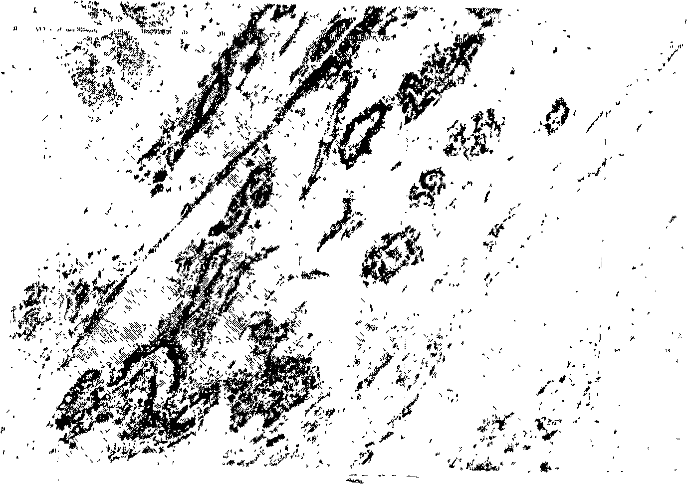 Medicine composition for treating mammary gland hyperplasia and its extracting preparing method