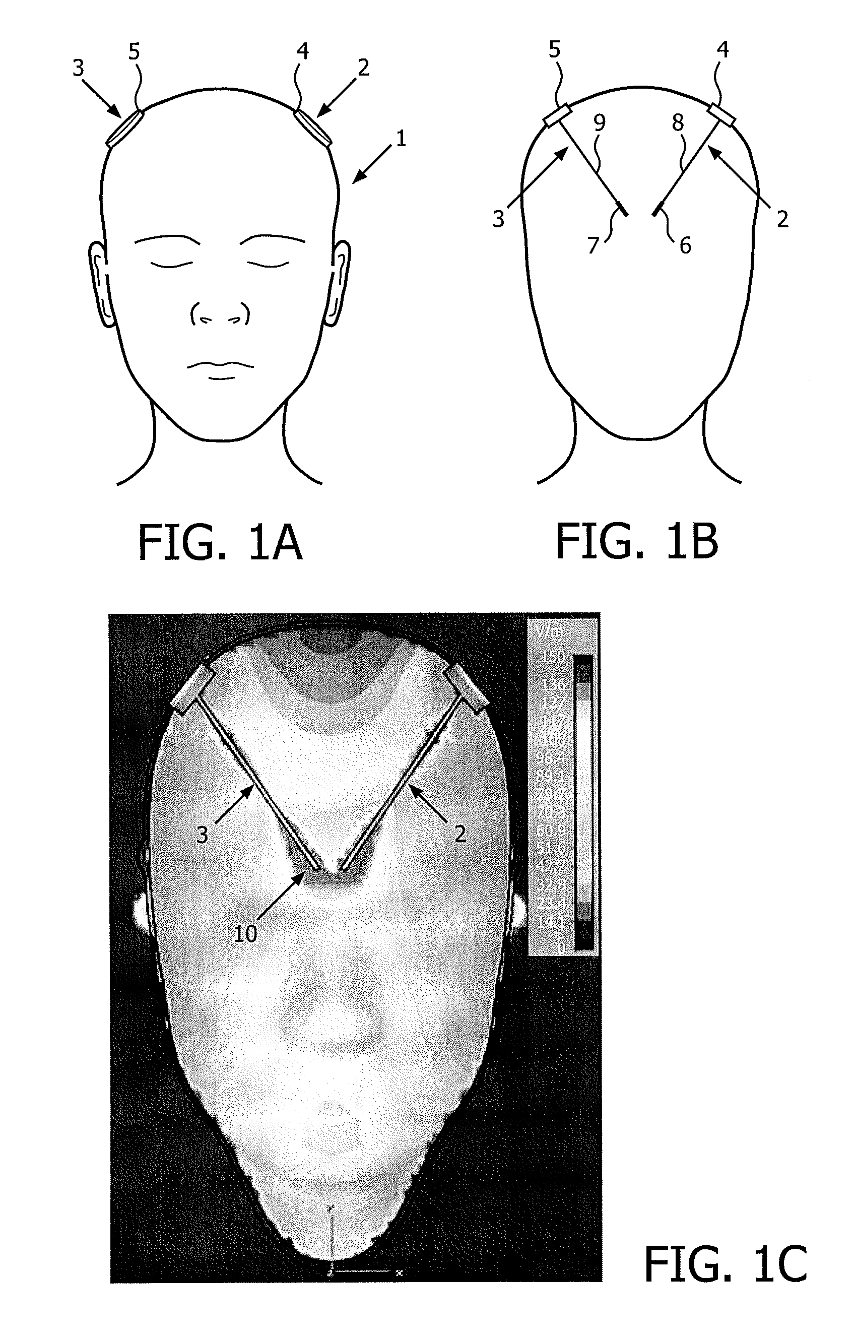 Medical device for electrical stimulation