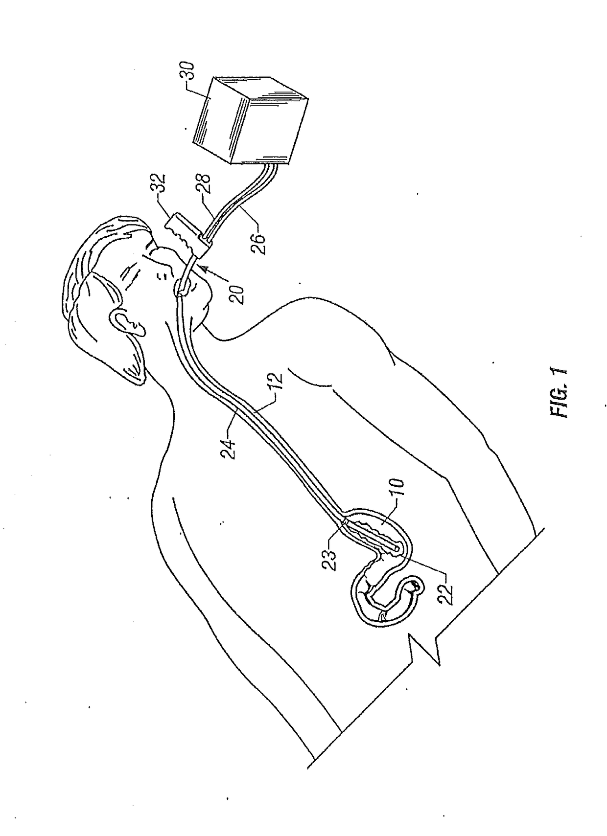 Apparatus and method for esophageal cooling