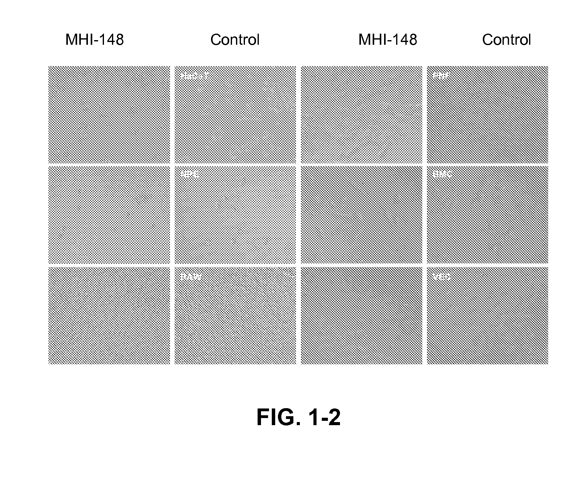 Cyanine-containing compounds for cancer imaging and treatment