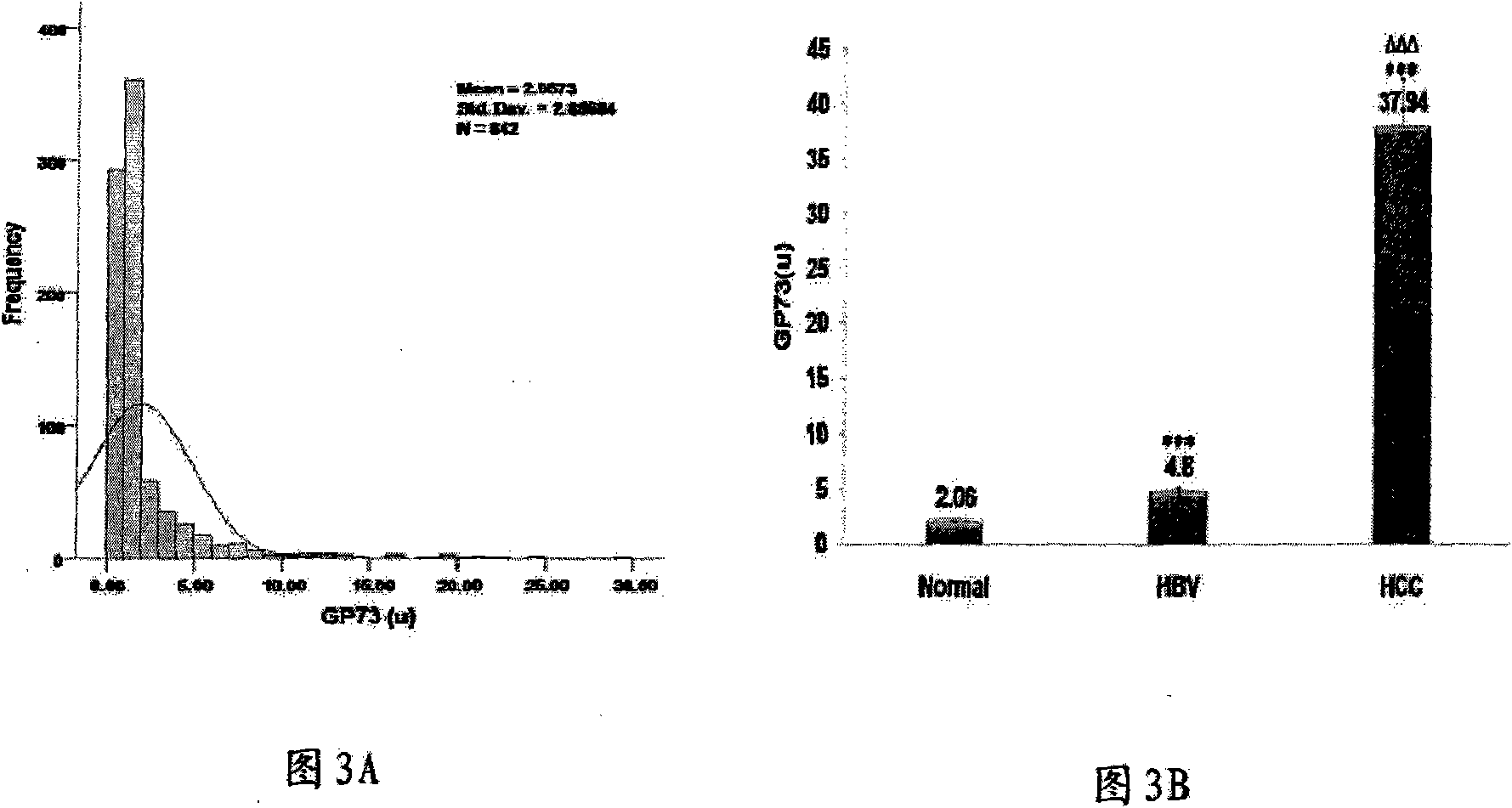 Antibody of fucosylated Golgi protein GP73 and use thereof