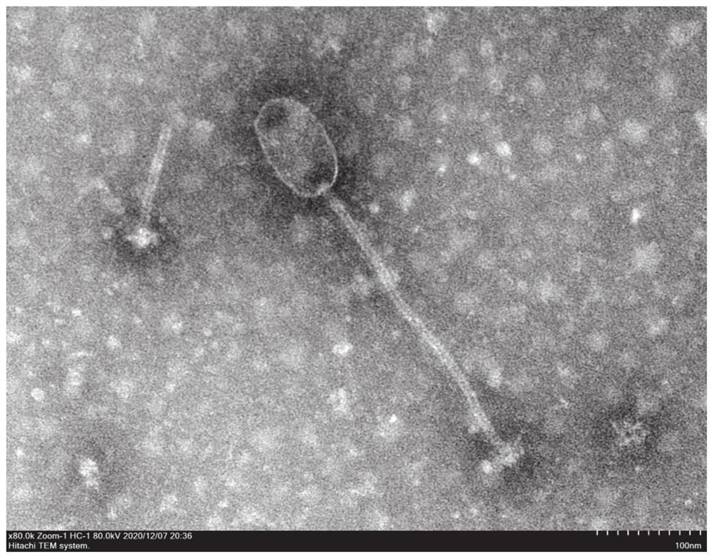 Staphylococcus aureus phage and bacteriostatic application thereof