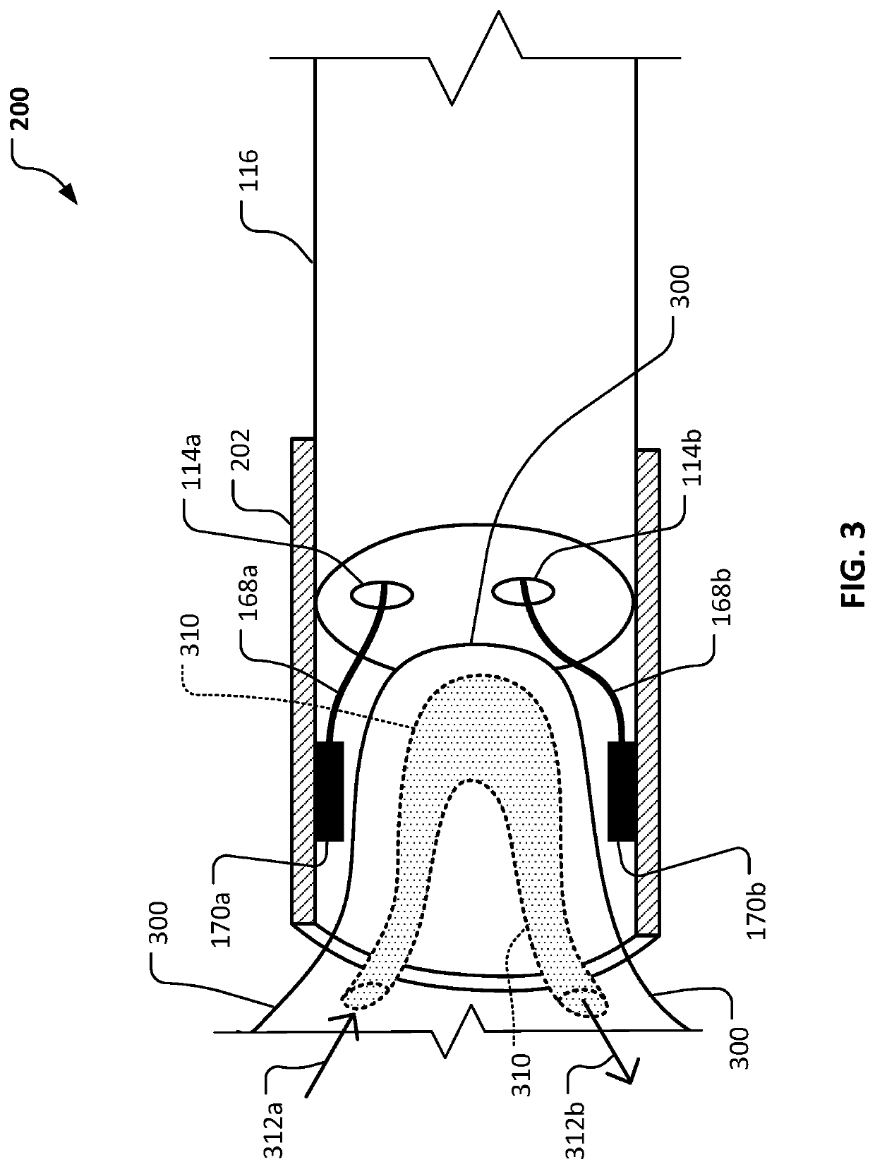 Thermal therapy systems and methods