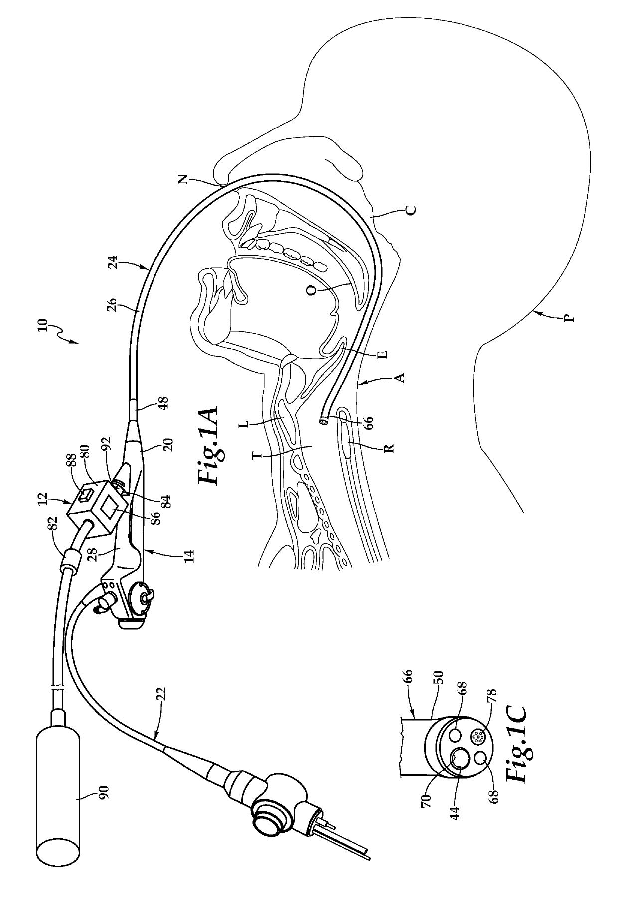 Medication delivery apparatus and accompanying system for the application of local anesthetics to a treatment site and method for use of same