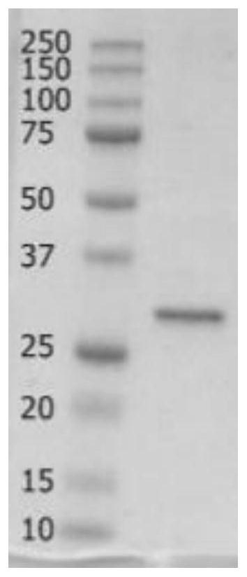 Fab fragment of human anti-human CD23 antibody, pharmaceutical composition and application of Fab fragment