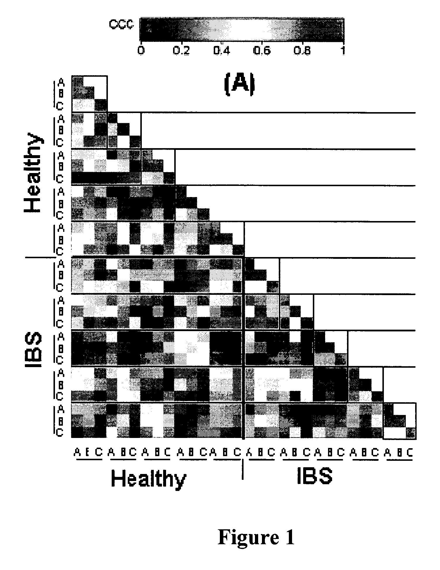 Compositions and methods for treating and diagnosing irritable bowel syndrome