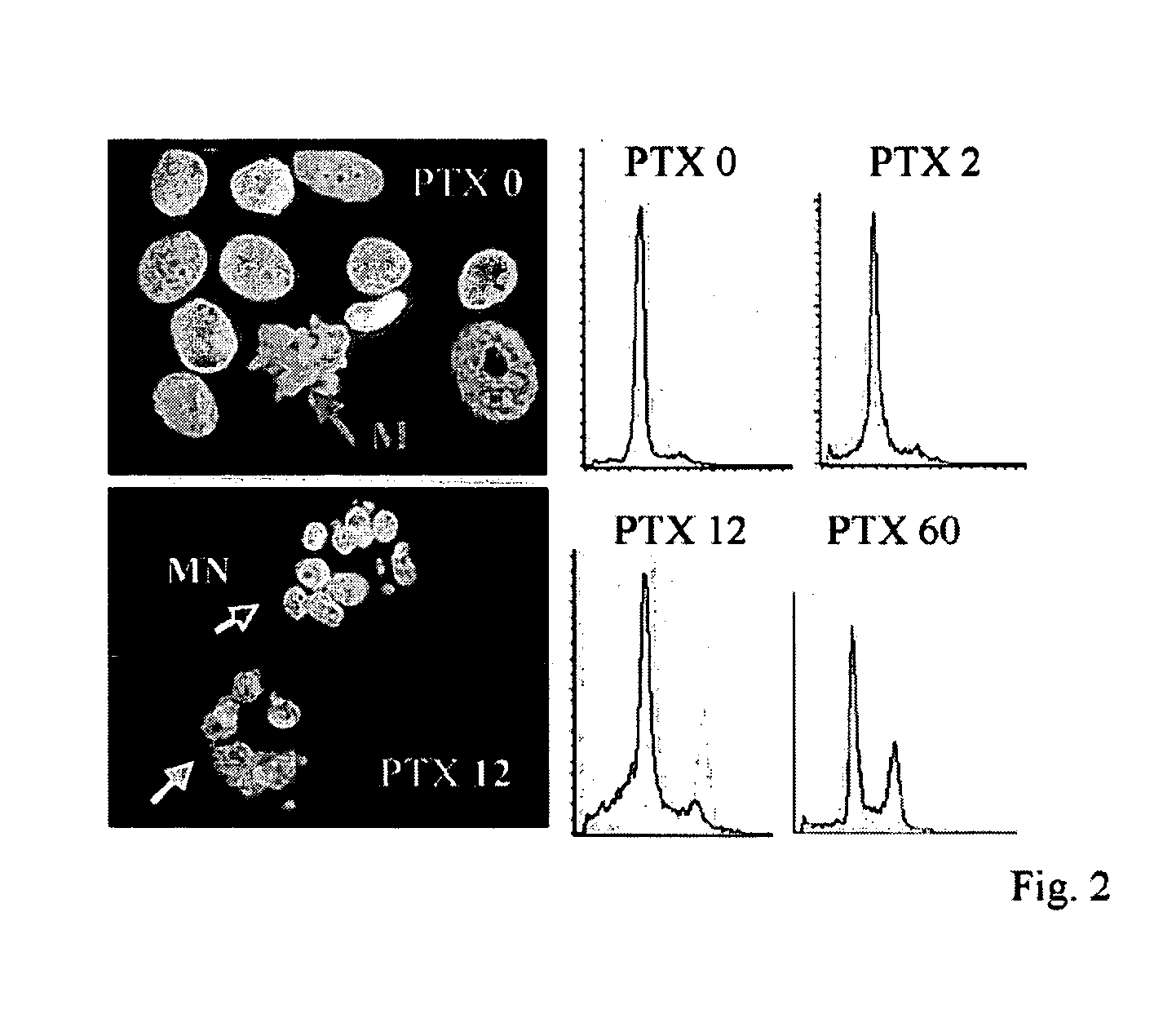 Medical devices and methods for inhibiting smooth muscle cell proliferation