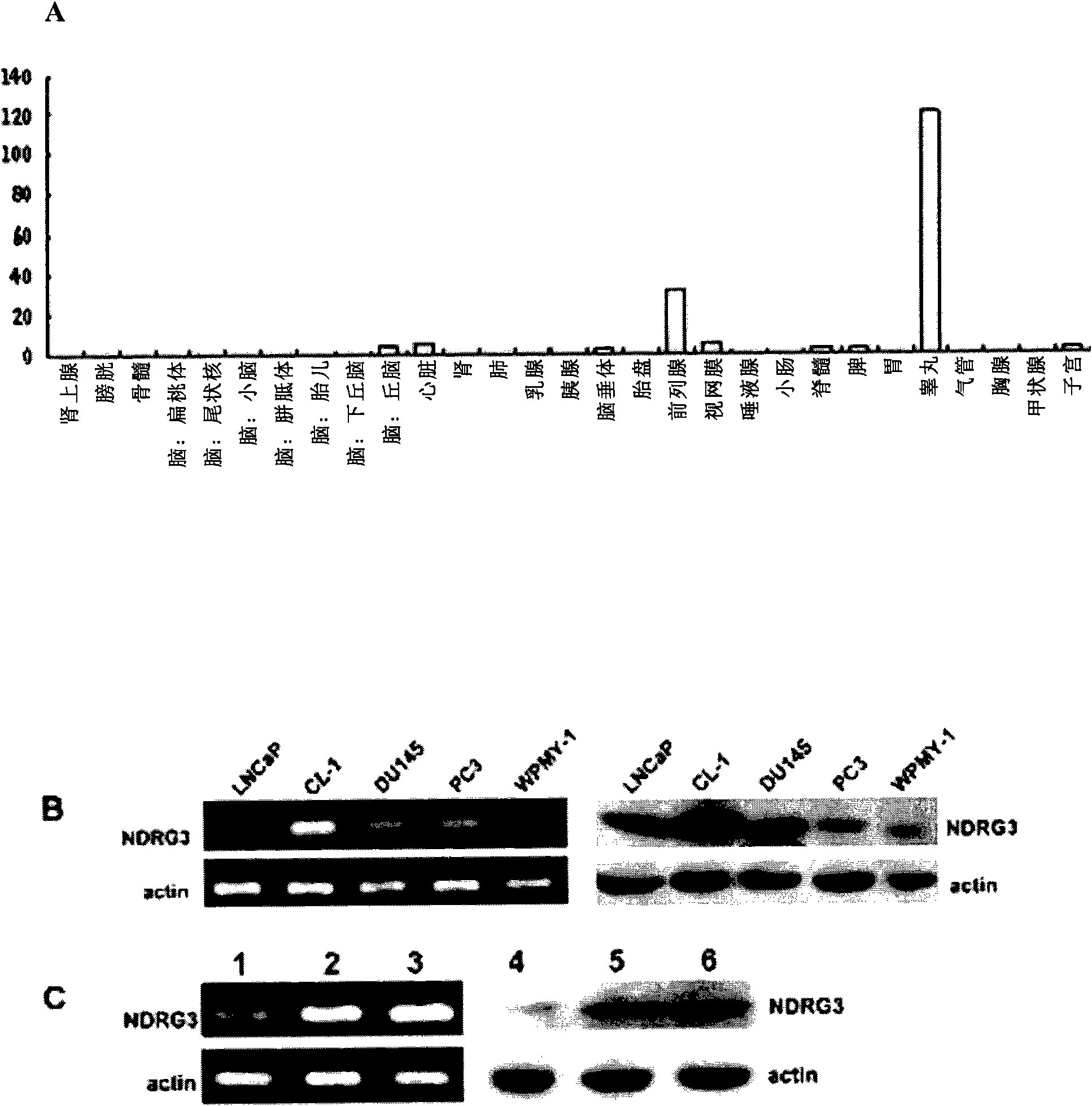 Prostatic cancer related gene and application thereof