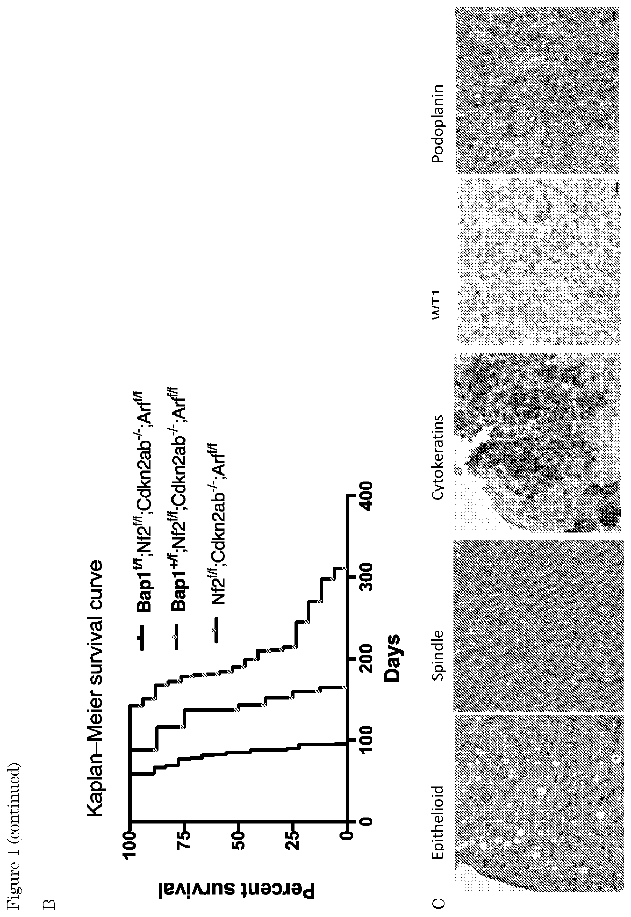 Ezh2- FGFR inhibition in cancer