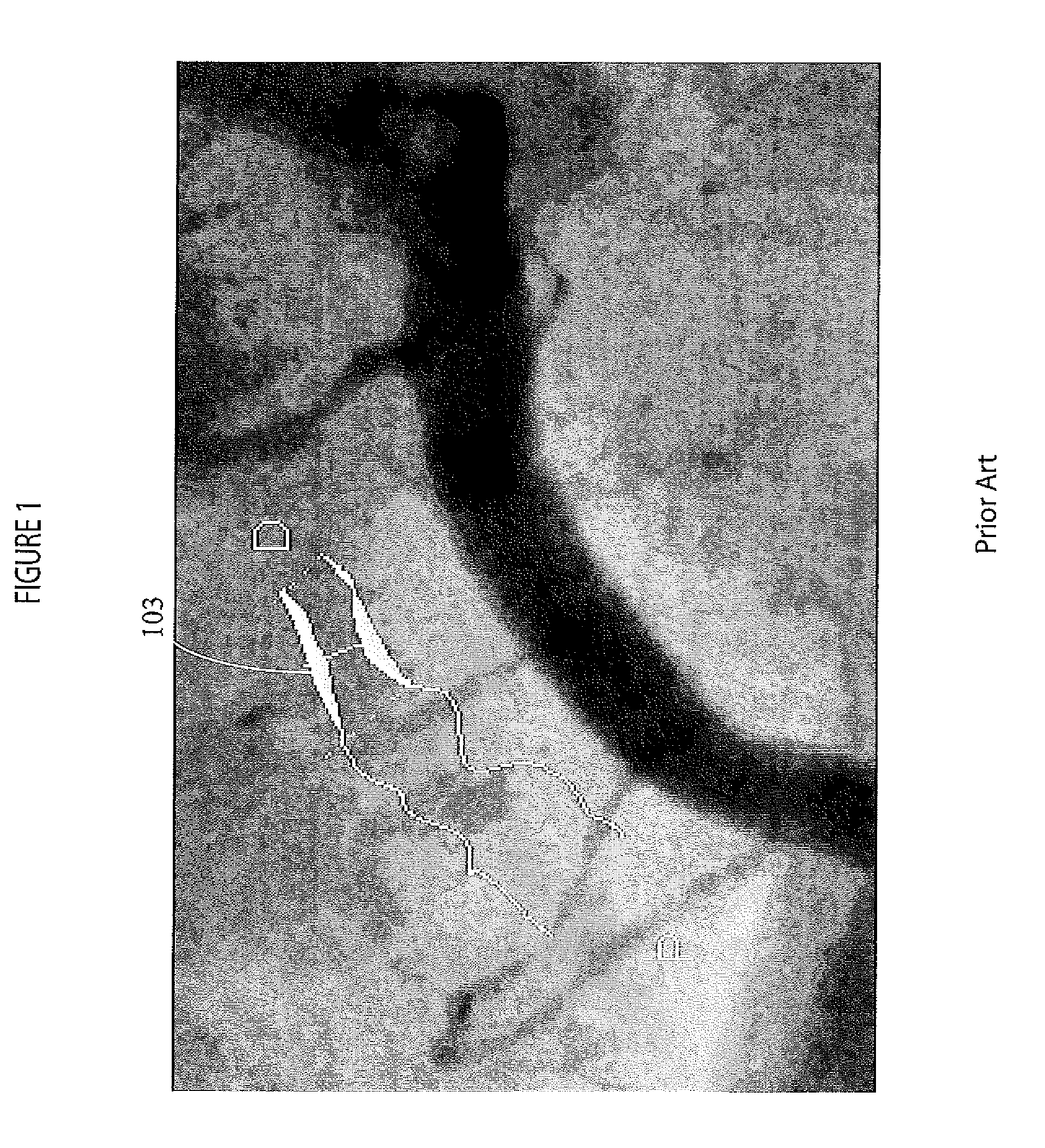 Automated system for anatomical vessel characteristic determination