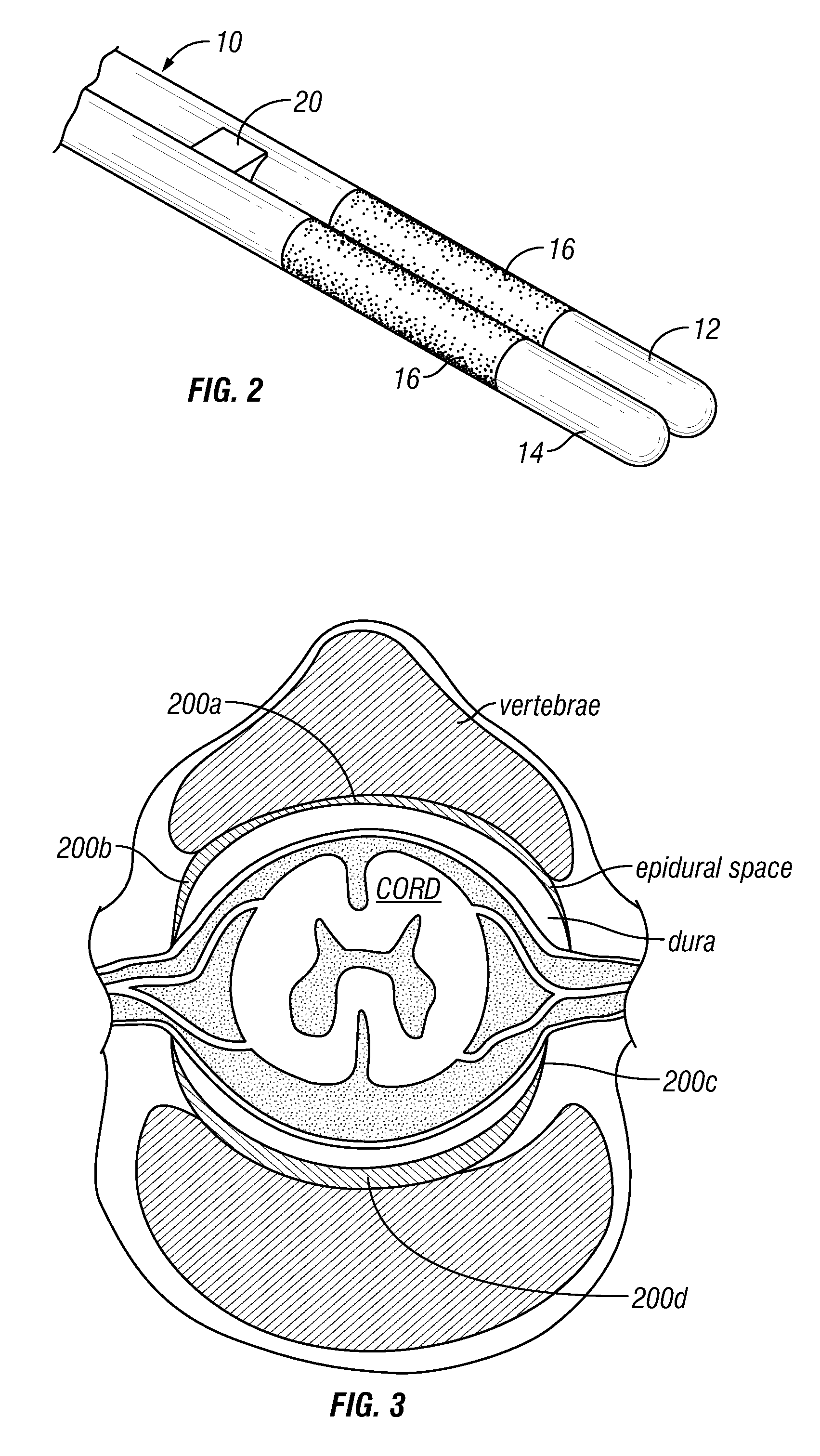 Systems, Methods and Apparatus for Treating Cardiac Dysfunction with Neurostimulation
