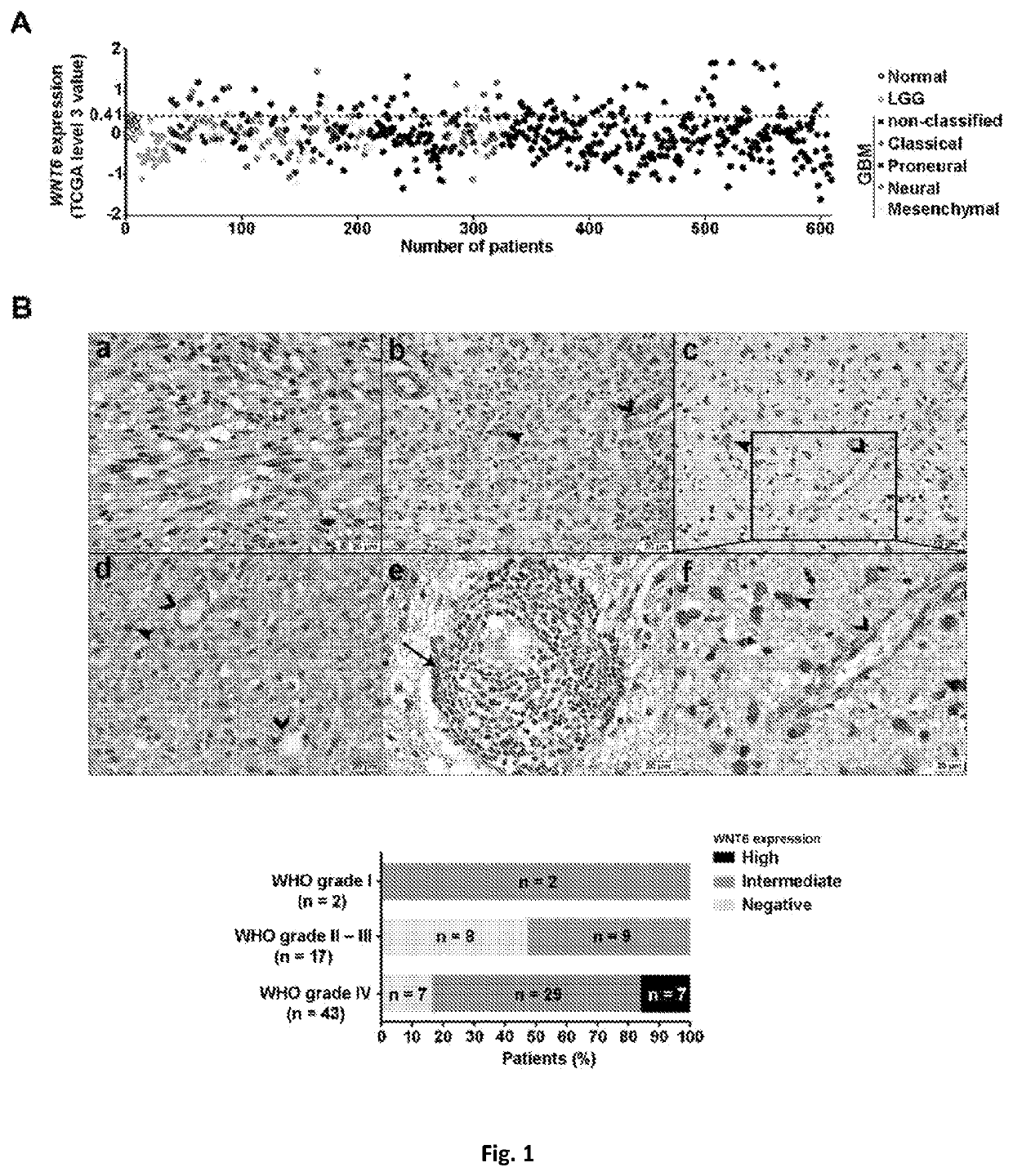 Wnt6 as glioblastoma oncogenic biomarker, and uses of inhibitors thereof