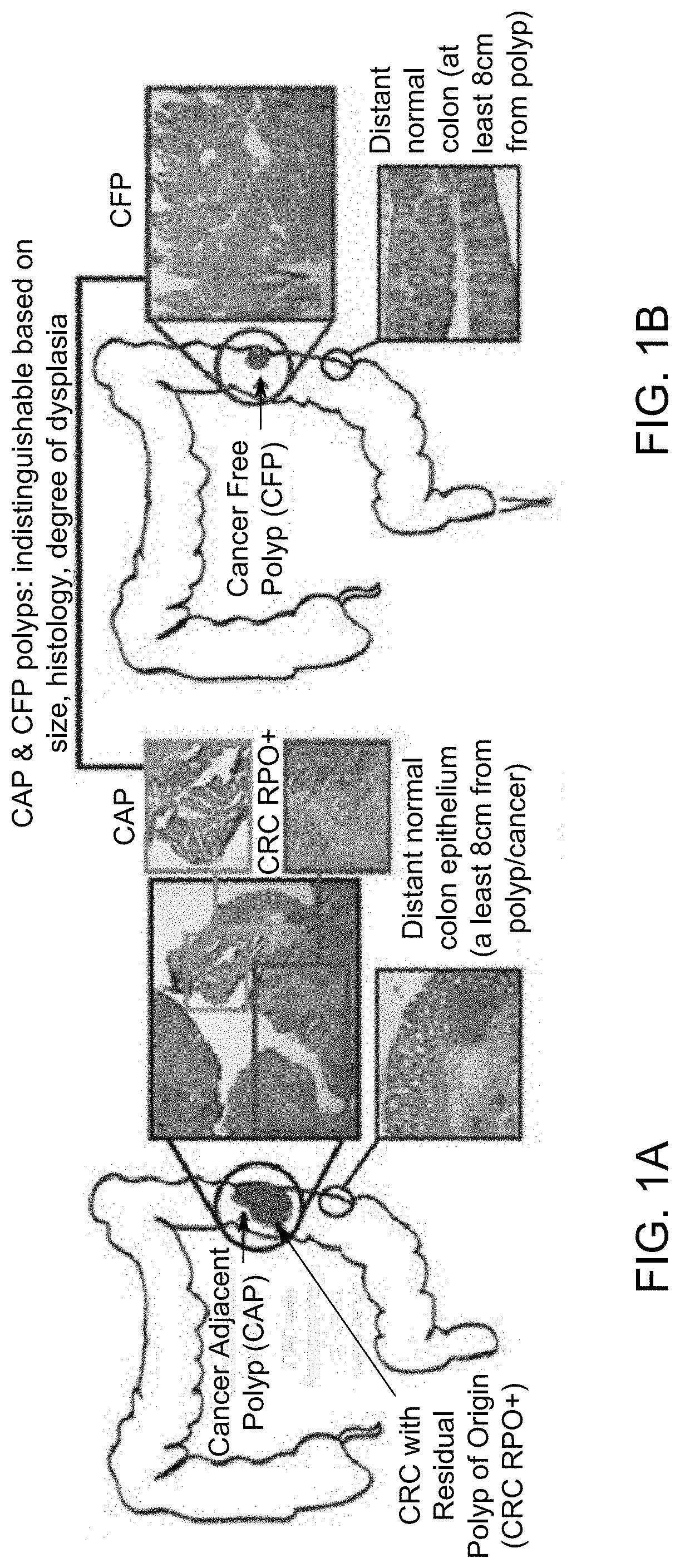 Assessing and treating mammals having polyps