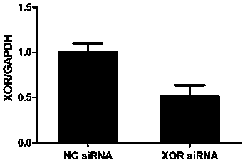 siRNA (small interfering Ribonucleic acid) for specifically inhibiting XOR (oxidoreductase) gene expression and application of siRNA