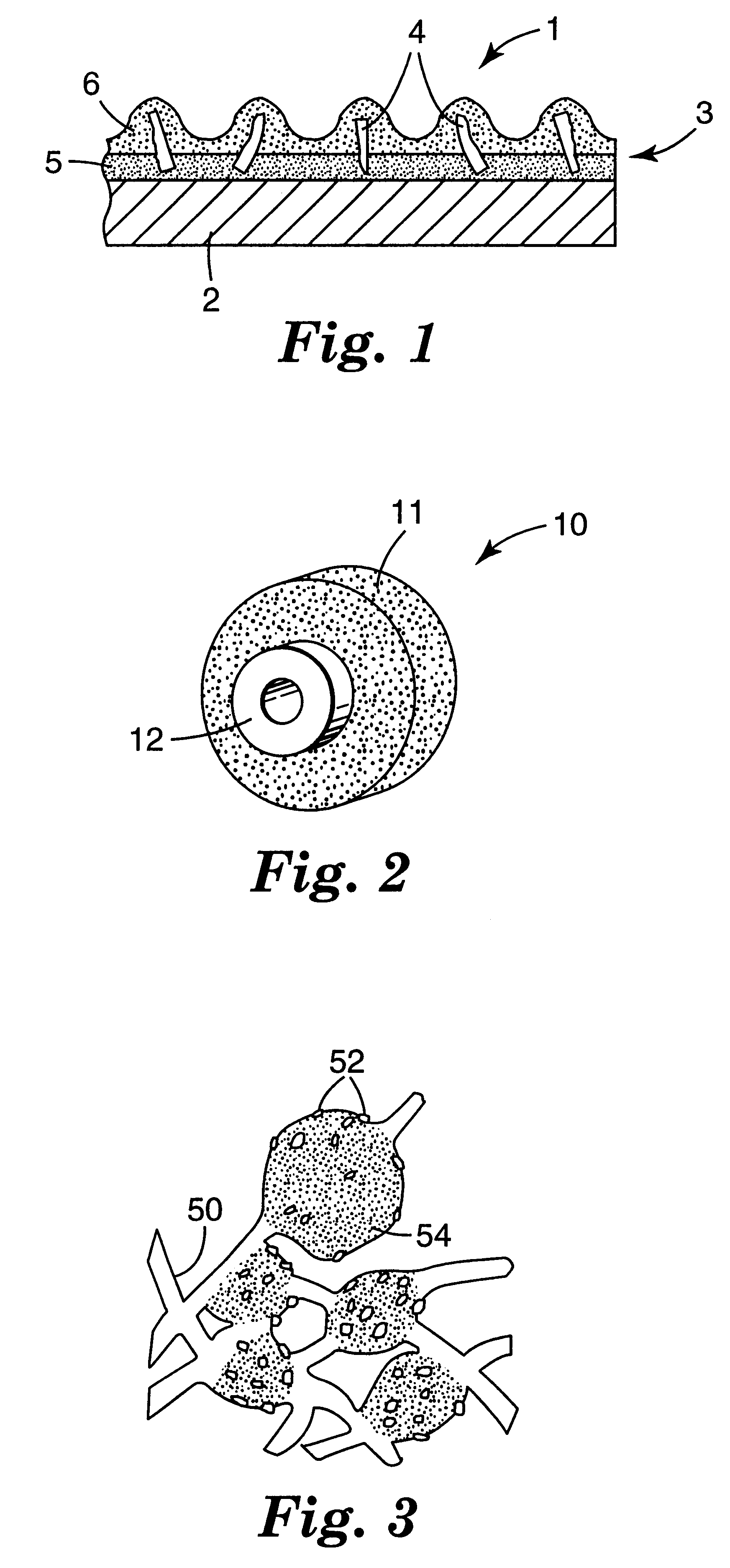 Fused AL2O3-MgO-rare earth oxide eutectic abrasive particles, abrasive articles, and methods of making and using the same