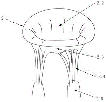 Mitral balloon closing plate obstruction body implanted via tip of heart and implantation method