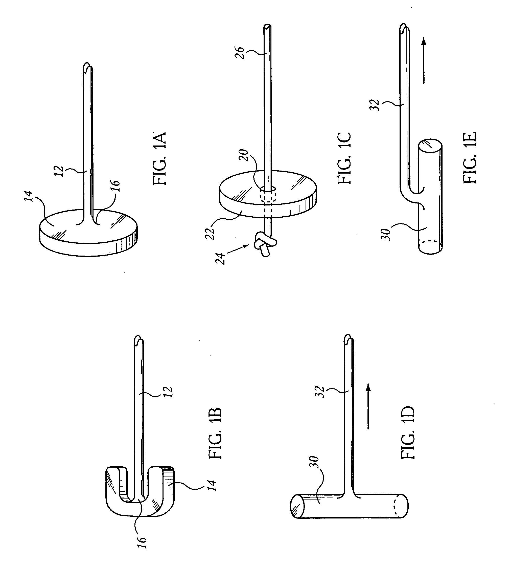 Extragastric devices and methods for gastroplasty
