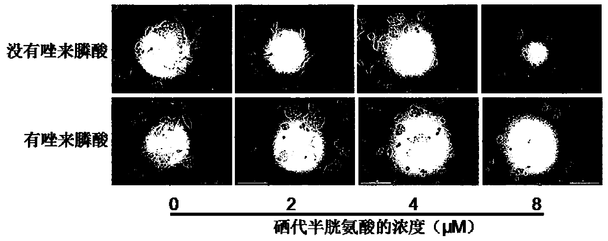 Application of combination of zoledronic acid and organic selenium compound in preparation of antitumor drugs