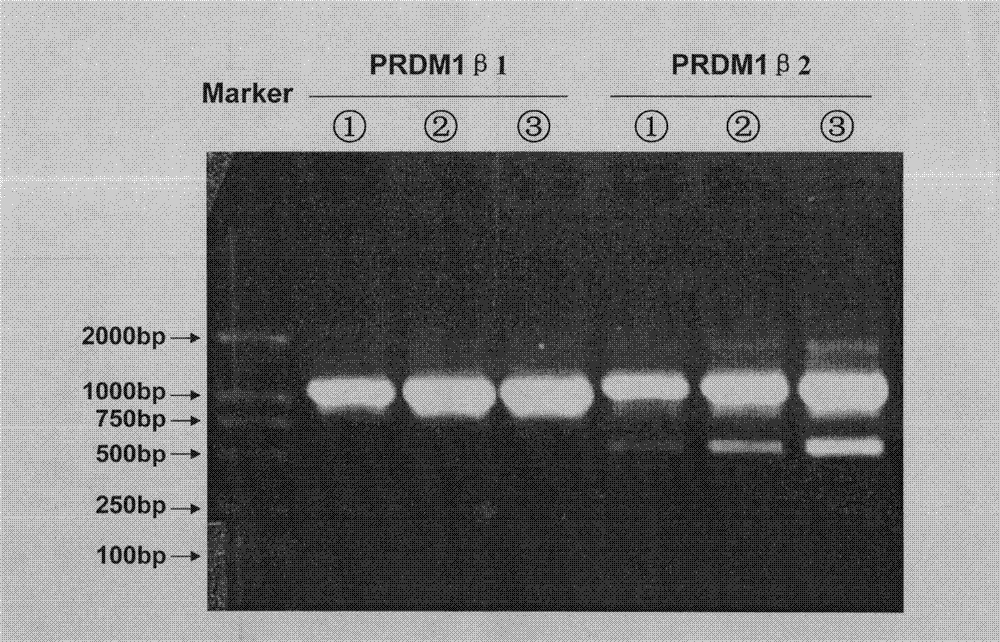 Group of siRNA molecules capable of effectively reducing PRDM1beta expression and application thereof