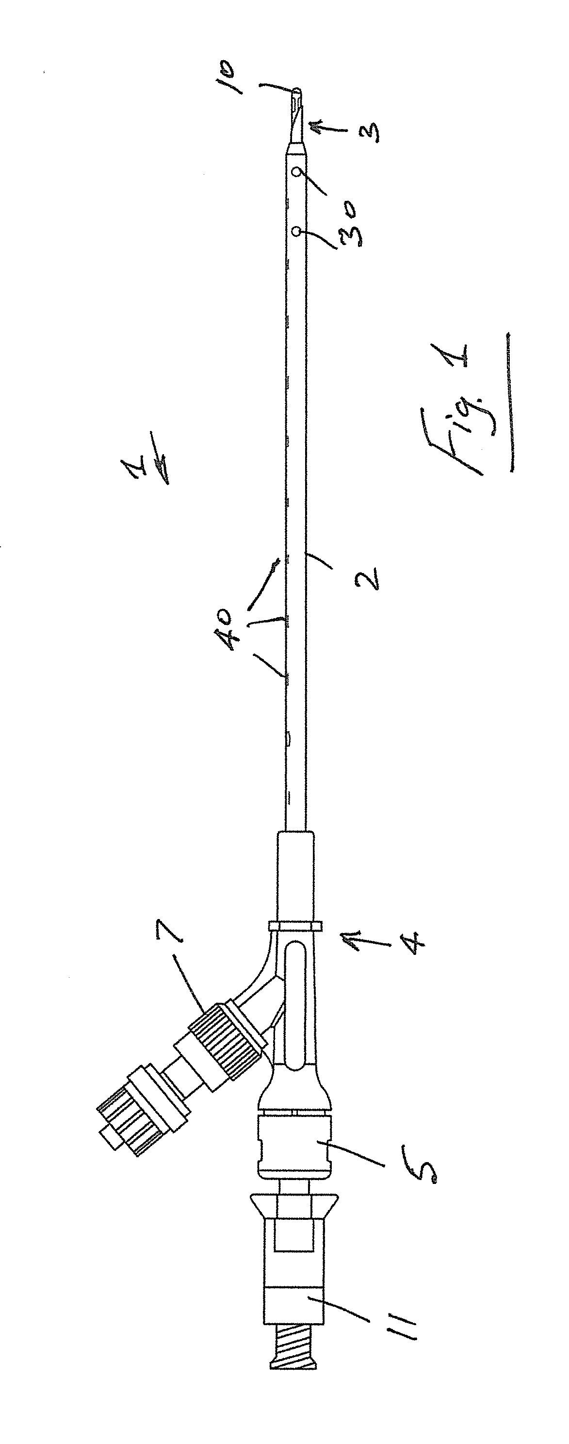 Transcutaneous device for removal of fluid from a body