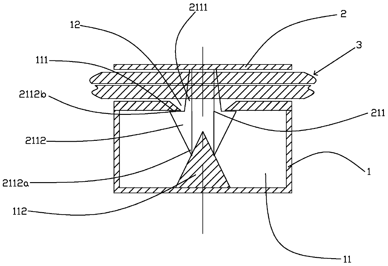 vaginal suture buckle