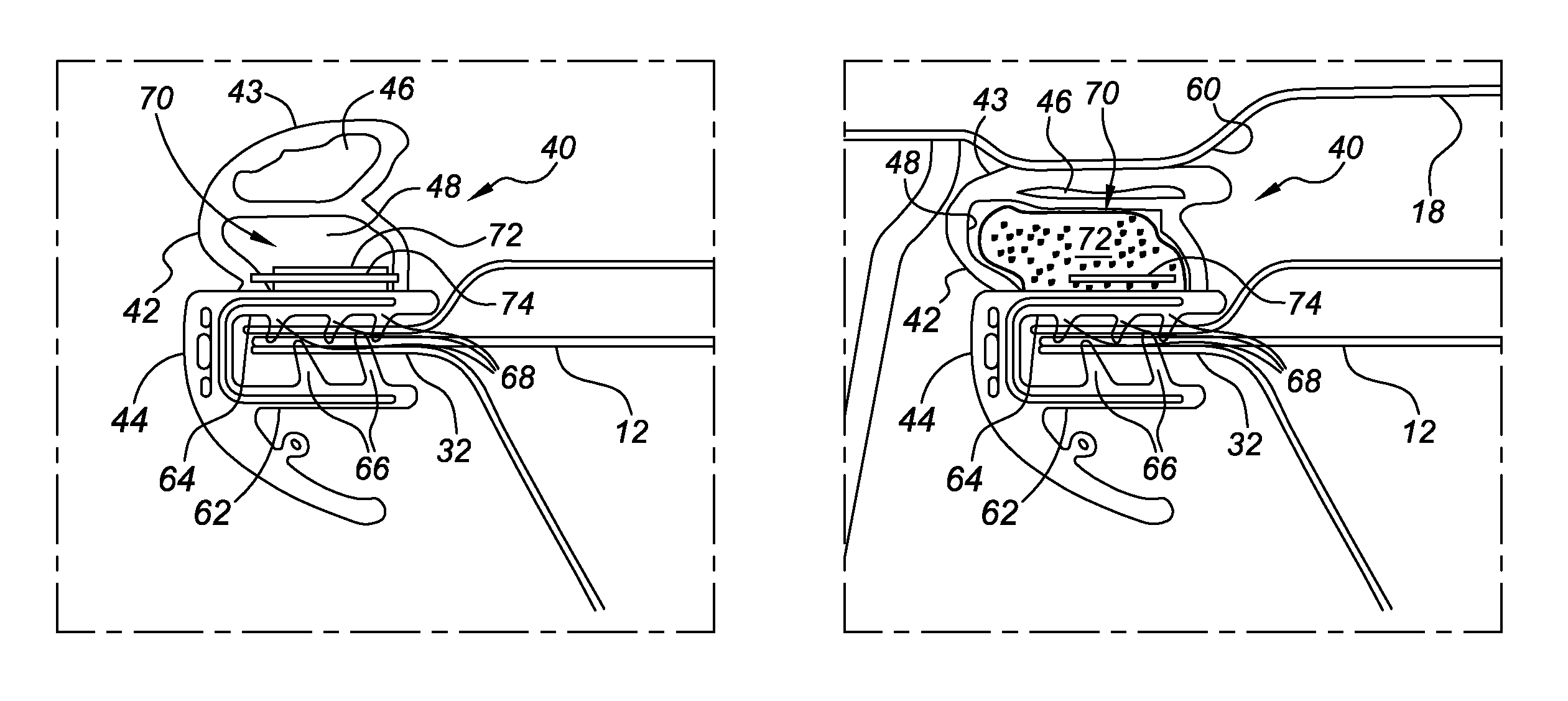 Vehicle closure assembly with shape memory polymer seal