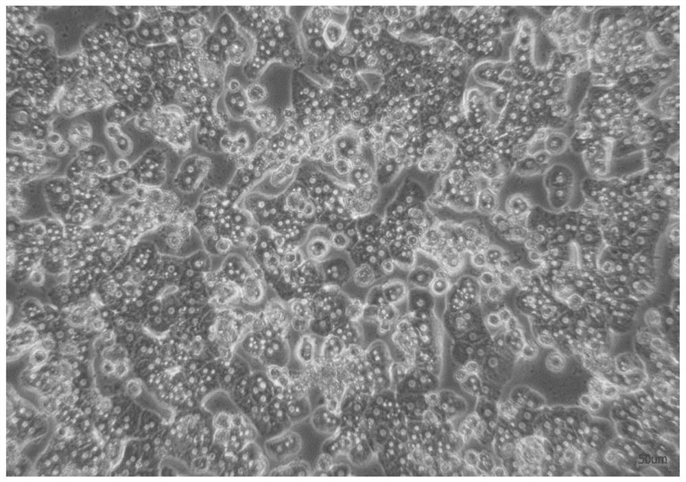 Separation liquid for removing dead liver cells and method for removing dead liver cells using same