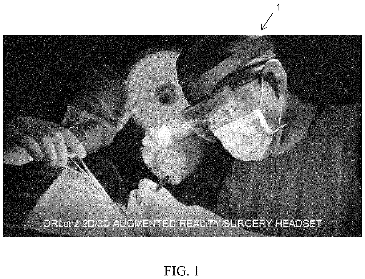 Augmented and extended reality glasses for use in surgery visualization and telesurgery