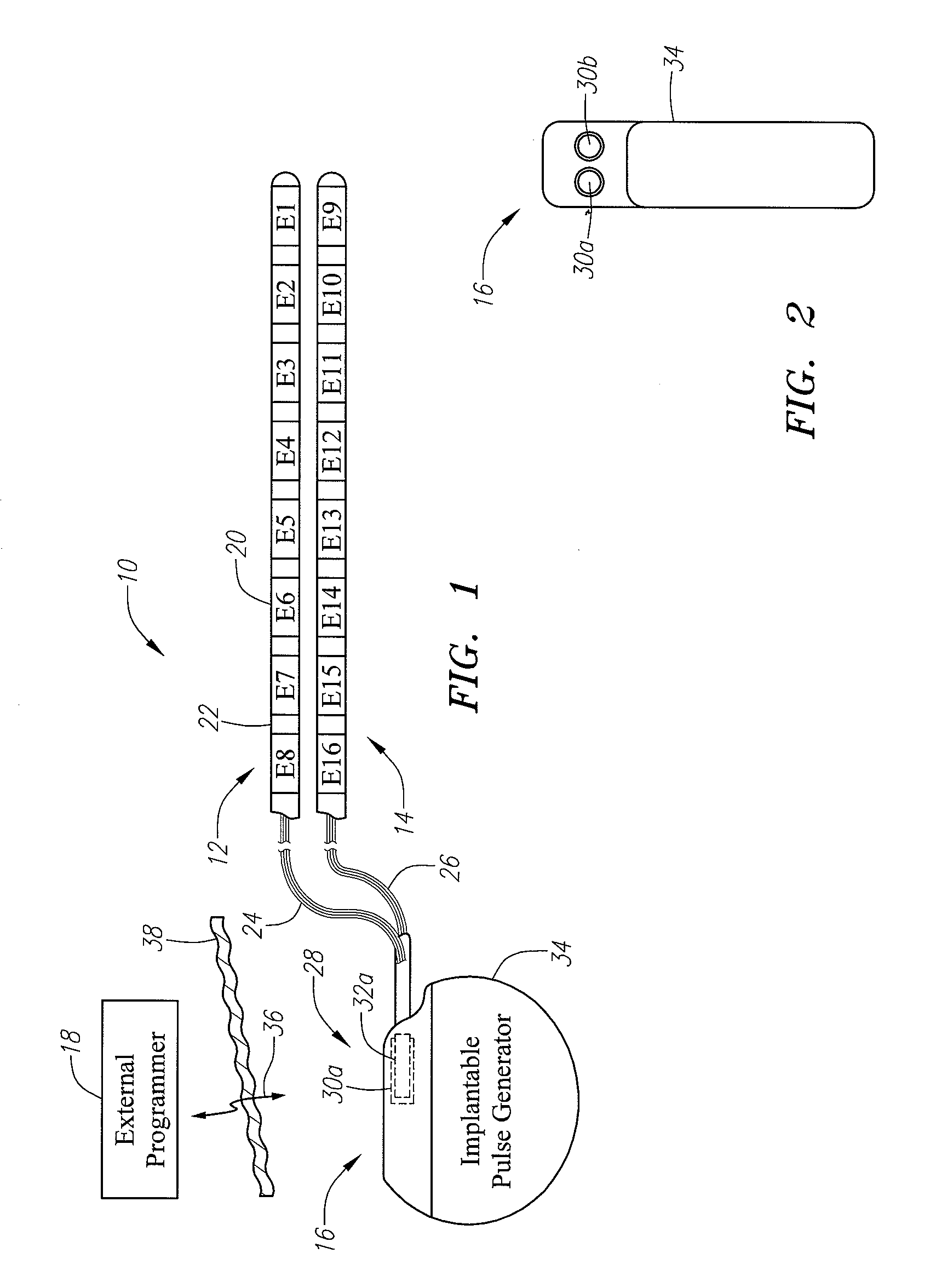 System and method for computationally determining migration of neurostimulation leads