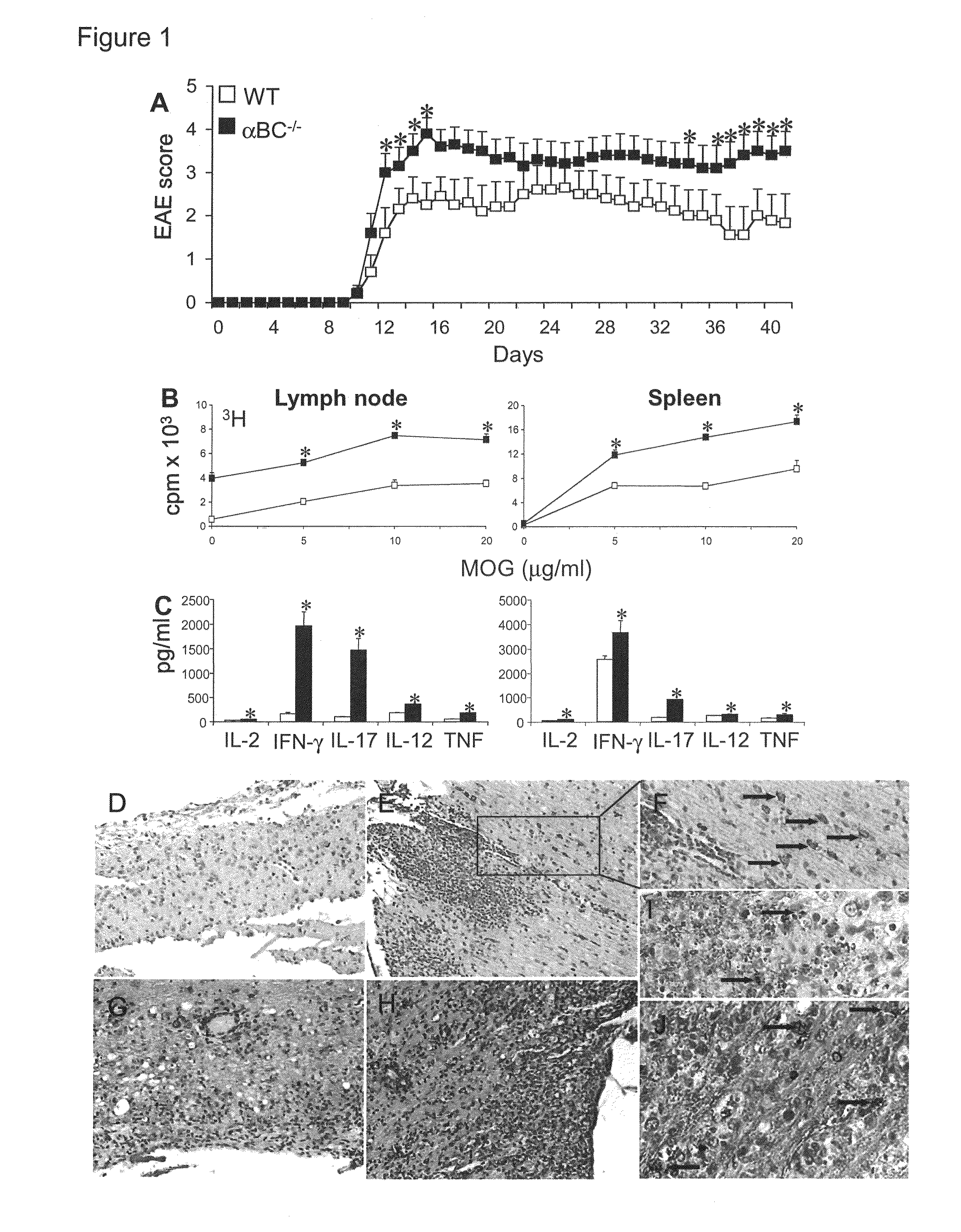 Alpha B-crystallin as a therapy for ischemia or inflammation